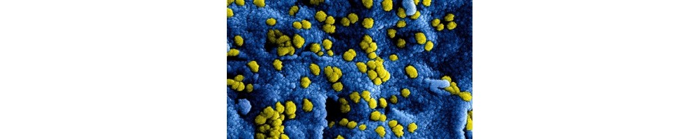 Infezioni batteriche e virali