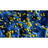 Infezioni batteriche e virali